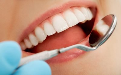 A Patient’s Guide to Dental Implants