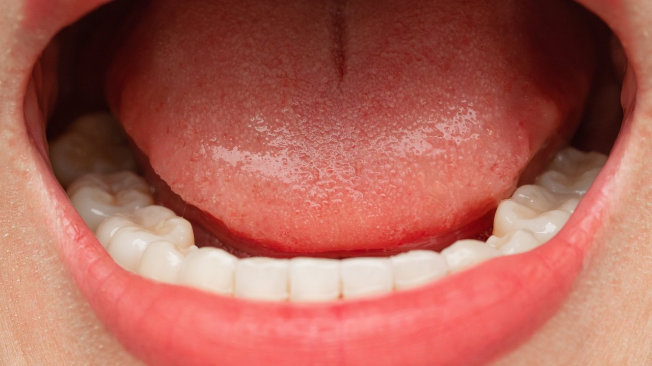 Dental Teeth Fillings - York Village Dental