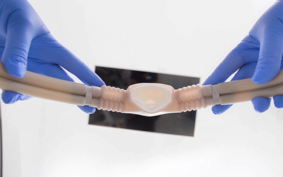 sedation dentistry nitrous oxide - York Village Dental